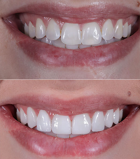 The Art of Facial Harmony: Part-3